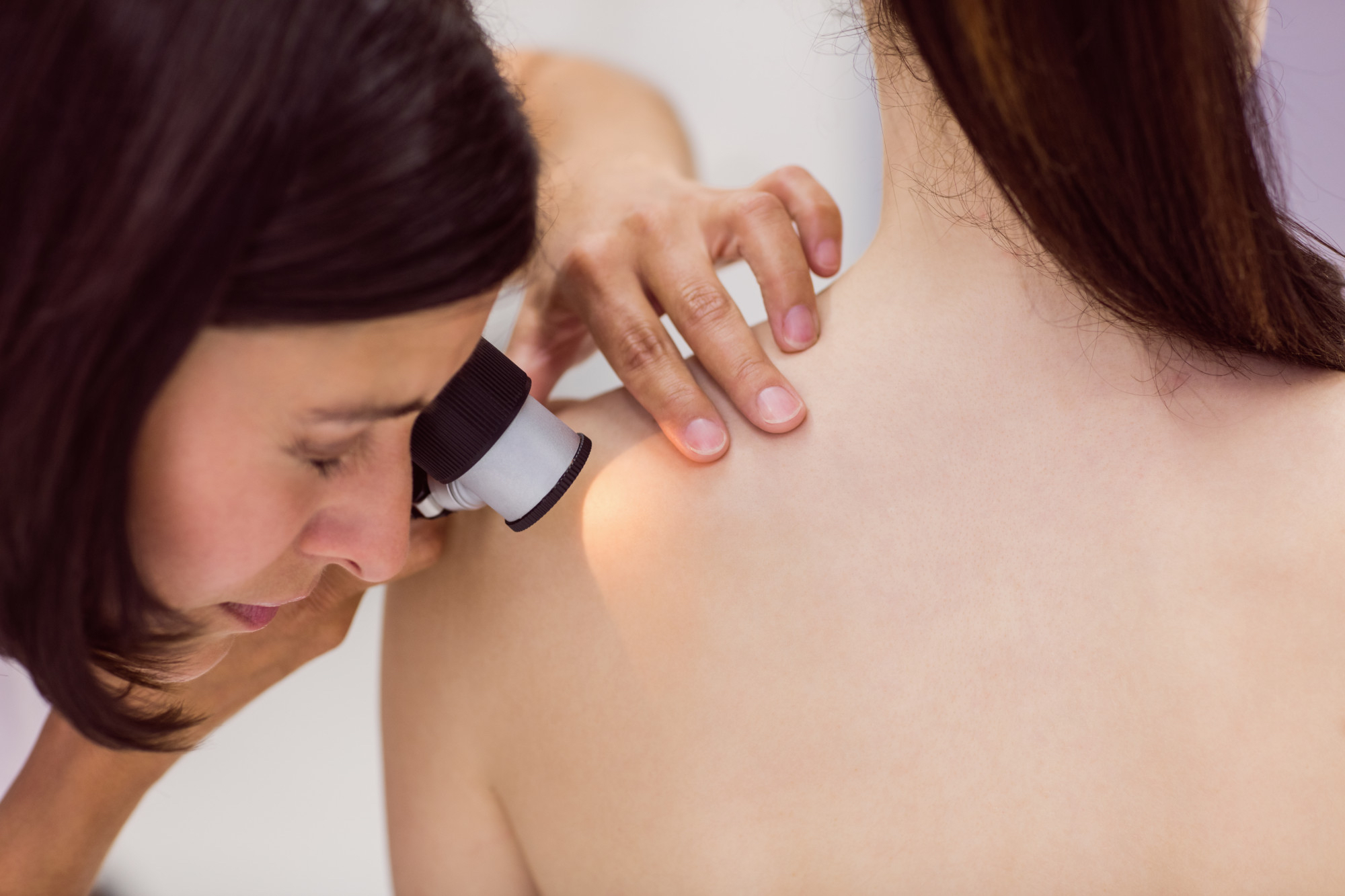 Dermatoskopia - kedy je potrebné ju absolvovať, a čo ukáže