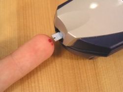 Diabetická nefropatia