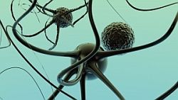 Sclerosis multiplex - roztrúsená skleróza